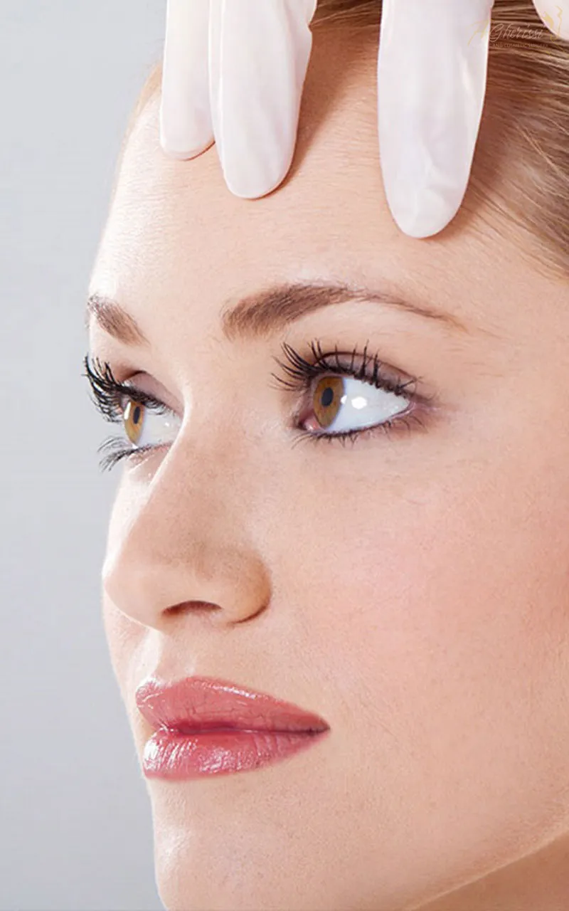 Lifting du visage