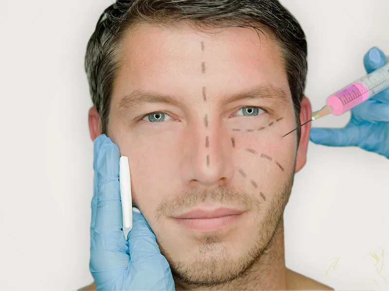 Chirurgie de l&#039;homme