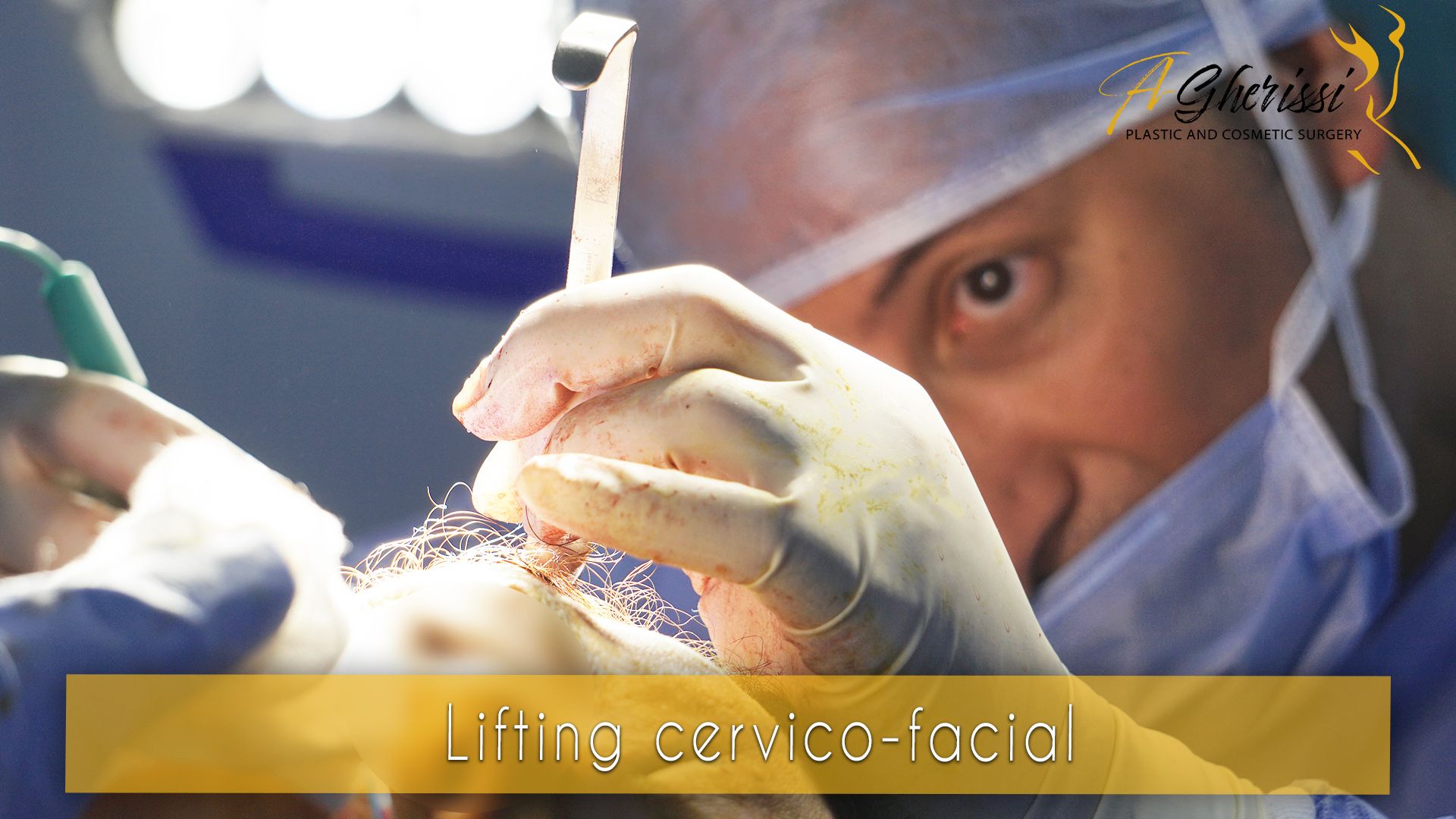 Lifting cervico facial