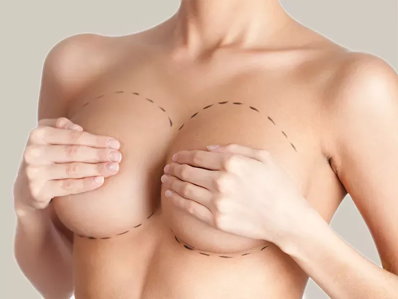 Augmentation mammaires par lipofilling