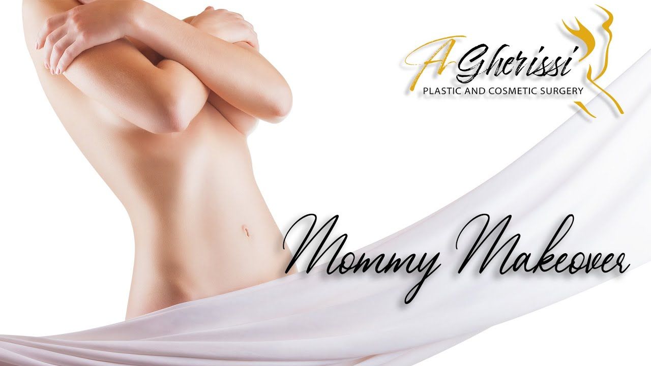 Mommy Makeover - liposuccion 360°, abdominoplastie et lifting seins